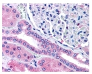 AP31414PU-N - Rhophilin 2 / RHPN2
