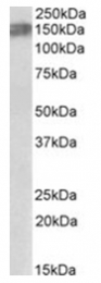 AP31403PU-N - CD246 / Anaplastic lymphoma kinase