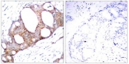 AP02309PU-S - GSK3 alpha