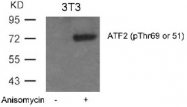 AP02331PU-N - ATF2