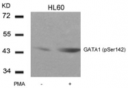 AP02341PU-S - GATA1