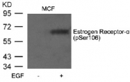 AP02369PU-S - Estrogen receptor alpha