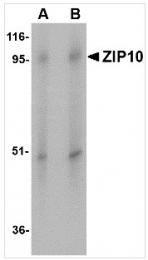 TA306711 - Zinc transporter ZIP10 / SLC39A10