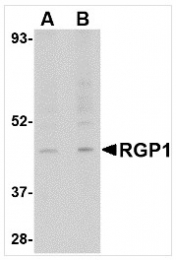 AP26328PU-N - RGP1