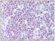 AM06006PU-N - POLD1