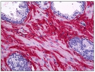 AM31694PU-N - Collagen type I