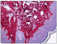AM31694PU-N - Collagen type I