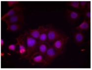 AP02370PU-S - Estrogen receptor alpha