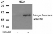 AP02370PU-S - Estrogen receptor alpha