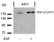 AP02373PU-S - CD340 / ERBB2 / HER2