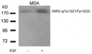 AP02374PU-S - CD340 / ERBB2 / HER2