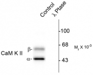 AP08911PU-N - CAMK2A/B