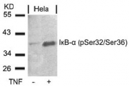 AP02436PU-N - NFKBIA / IKBA