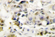 AP06737PU-N - MED1