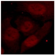 AP08014PU-N - HDAC2