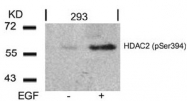 AP08014PU-N - HDAC2