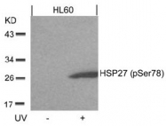 AP02500PU-N - HSPB1 / HSP27