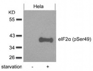 AP08033PU-N - EIF2A / EIF2S1