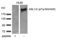 AP08038PU-S - ABL1 / ABL2