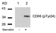AP08040PU-S - CDK6