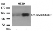 AP09494PU-N - FAK1 / PTK2