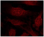 AP02546PU-S - GSK3 beta
