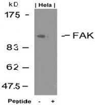 AP02673PU-S - FAK1 / PTK2