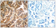 AP02702PU-S - Alpha-Adducin / ADD1