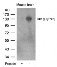 AP08028PU-S - TrkB
