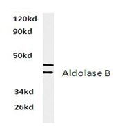 AP01402PU-N - Aldolase B / ALDOB