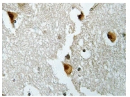 AP01402PU-N - Aldolase B / ALDOB
