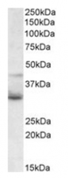AP15991PU-N - WNT4
