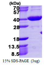 AR39046PU-L - AKR1C4