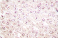 AP06334PU-N - Cystatin-B