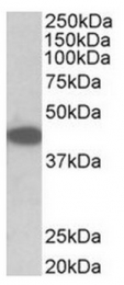 AP31575PU-N - TRIB1
