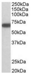 AP31572PU-N - GAD1 / GAD67