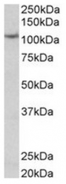 AP31571PU-N - Thyroid peroxidase (TPO)