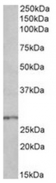 AP31564PU-N - HOXB9 / HOX2E