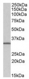 AP31560PU-N - SLC9A3R2 / NHERF2