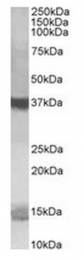 AP31558PU-N - PFDN1