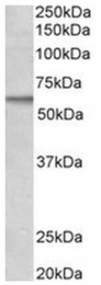 AP31557PU-N - ACVRL1 / ALK1