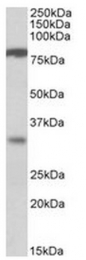 AP31555PU-N - CLCA1