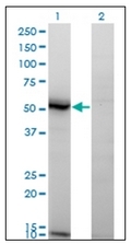AM31723PU-N - Acid ceramidase