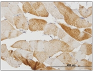 AM31729PU-N - Calsequestrin-2