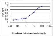 AM31726PU-N - SERPING1 / C1 Inhibitor
