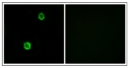 AP31617PU-N - Cystatin-SN