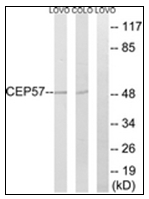 AP31613PU-N - CEP57