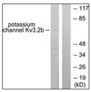 AP31609PU-N - KCNC2