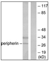 AP31608PU-N - UCHL1 / PGP9.5