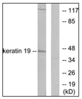 AP31607PU-N - Cytokeratin 19
